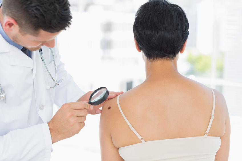 Melanoma Monday May 6th