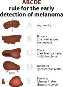 May is Skin Cancer Awareness Month