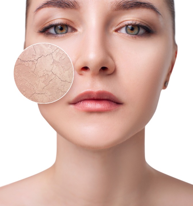 How To Make Dry Winter Skin Last Year's Problem